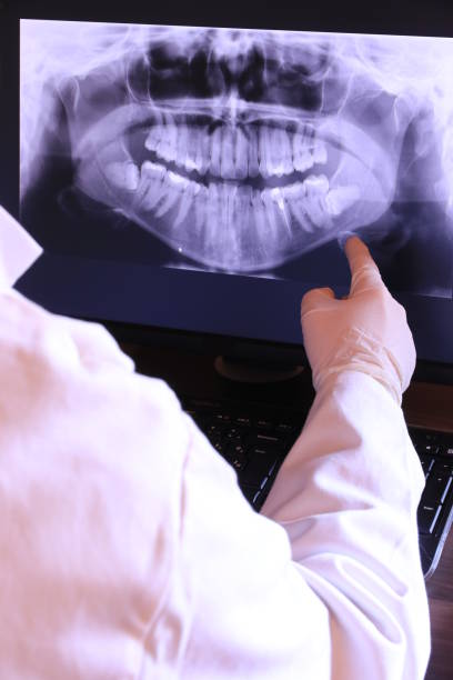 Best Emergency Dental Care for Abscessed Tooth in Belmont, NC